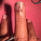 Illustration for article titled Here Is a Teeny Nail Growing on Top of Another Nail on Someones Middle Finger